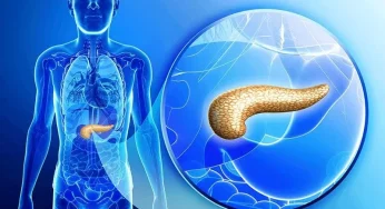 Pankreatitis Akut: Peradangan Organ Pankreas Secara Mendadak