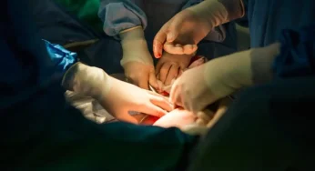 Kontroversi: Dokter Umum Boleh Lakukan Operasi Caesar?