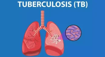 Tuberkulosis (TBC) Tewaskan 2 Orang Tiap 5 Menit, Waspada!