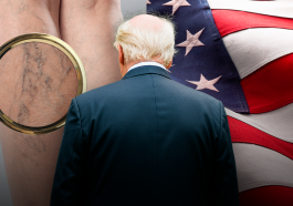 chronic venous insufficiency