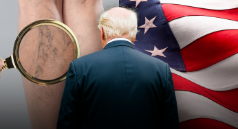 Donald Trump Diduga Alami Chronic Venous Insufficiency, Apa Itu?