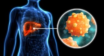 Hepatitis B Menginfeksi 6,5 Juta Warga RI, Ketahui Cara Penularannya