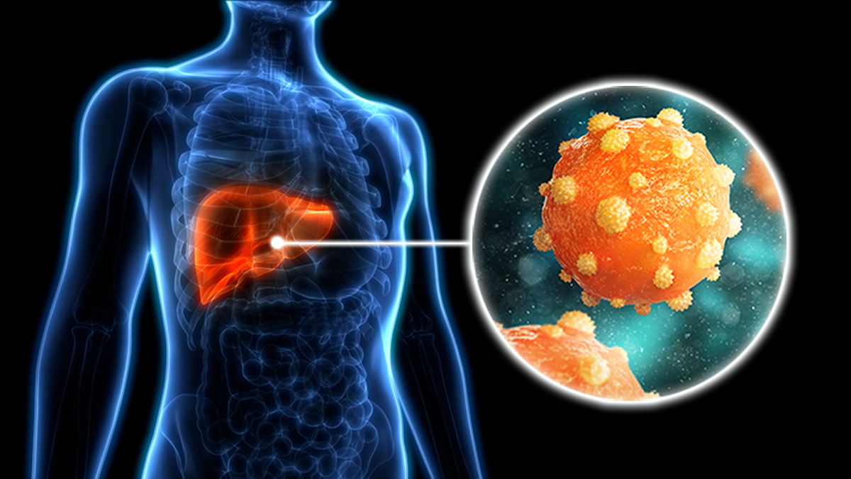 hepatitis b