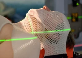 radioterapi kepala dan leher