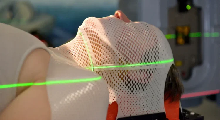 radioterapi kepala dan leher