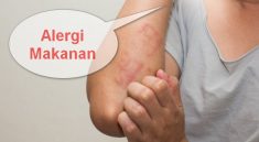 alergi makanan