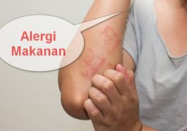 alergi makanan