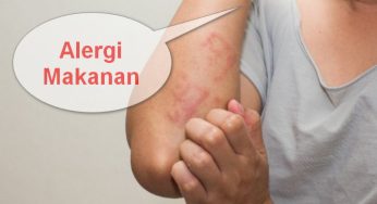 Mengapa Alergi Makanan Bisa Menghambat Tumbuh Kembang Anak? Begini Kata Dokter