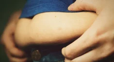 Adakah Cara Mengecilkan Perut Buncit secara Alami?